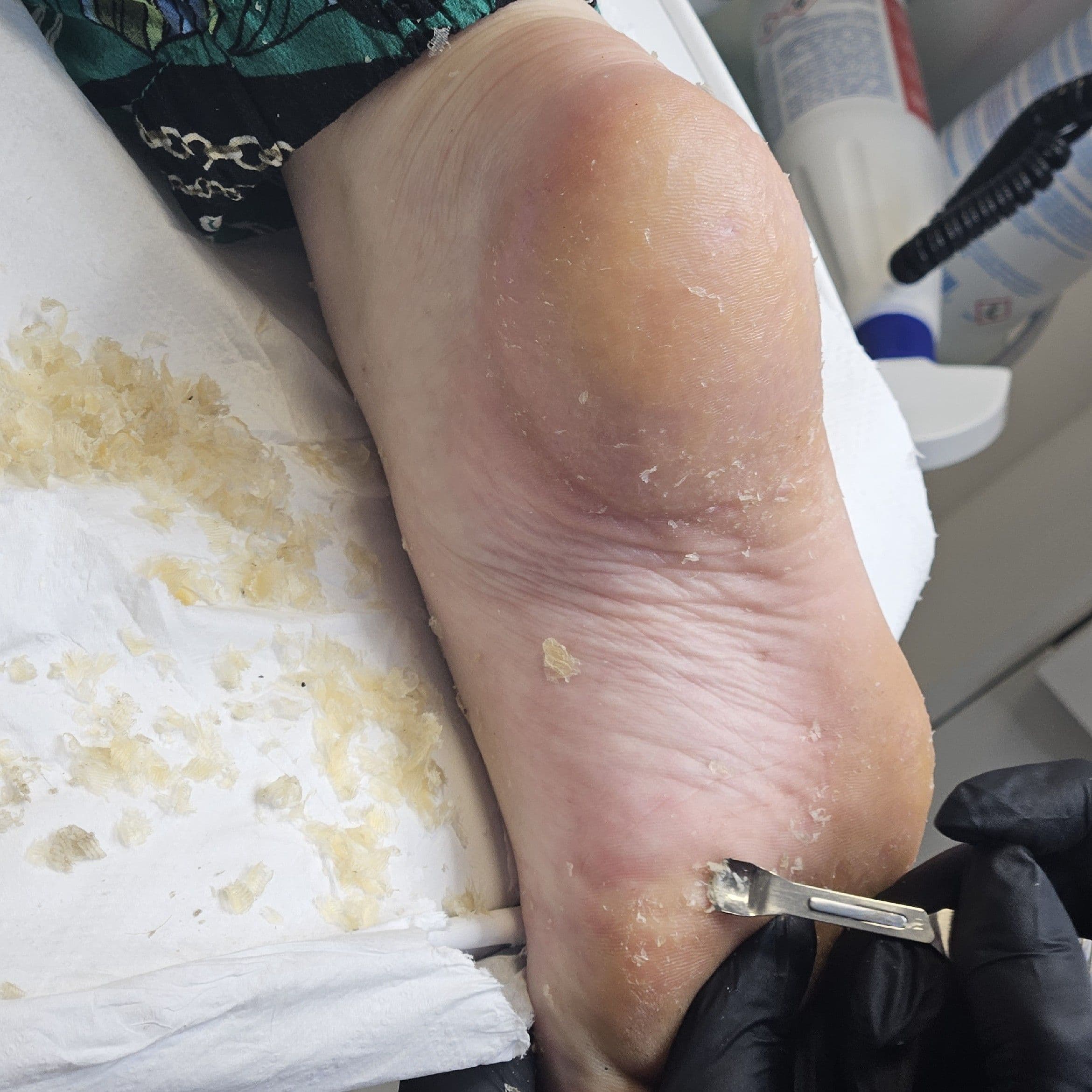 Zdjęcie dotyczące usługi