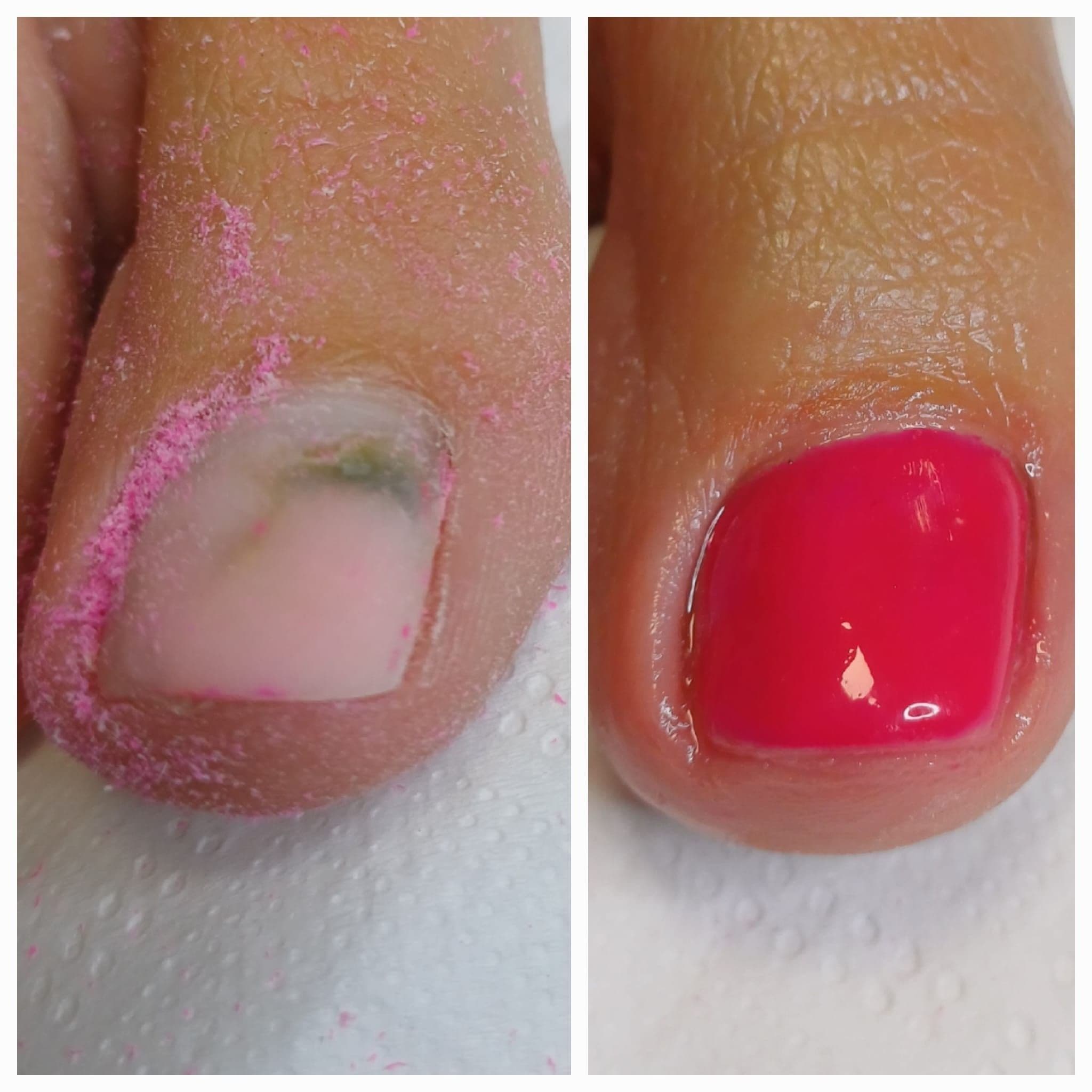 Zdjęcie dotyczące usługi