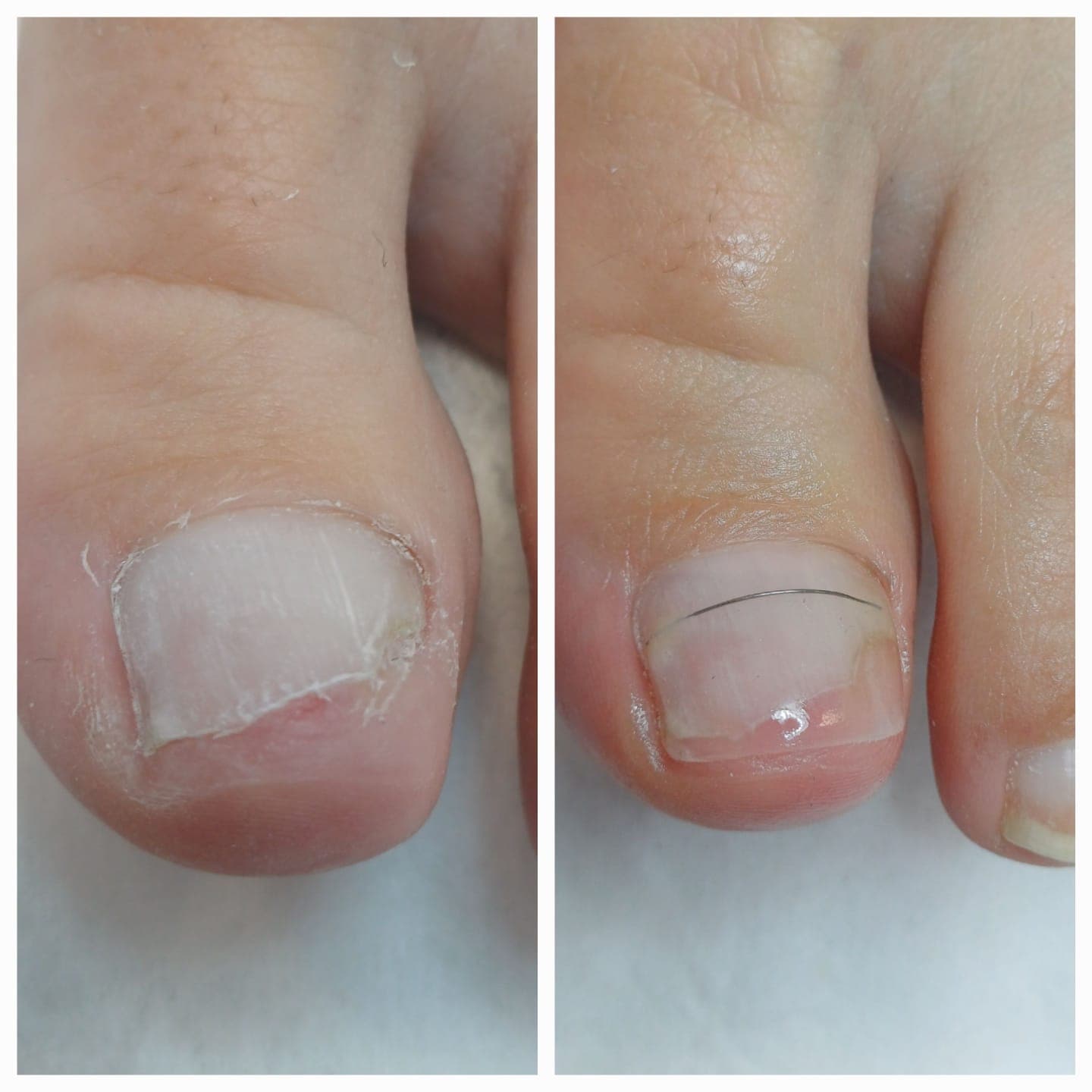 Zdjęcie dotyczące usługi